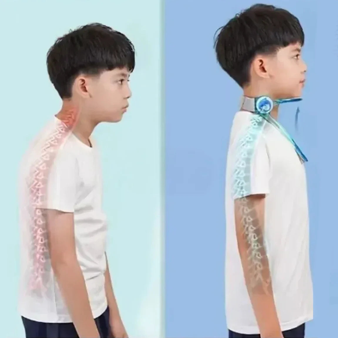 Childrens neck brace